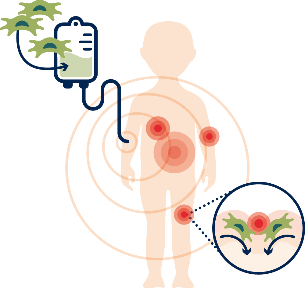 How ABCB5+ MSCs target the EB burden