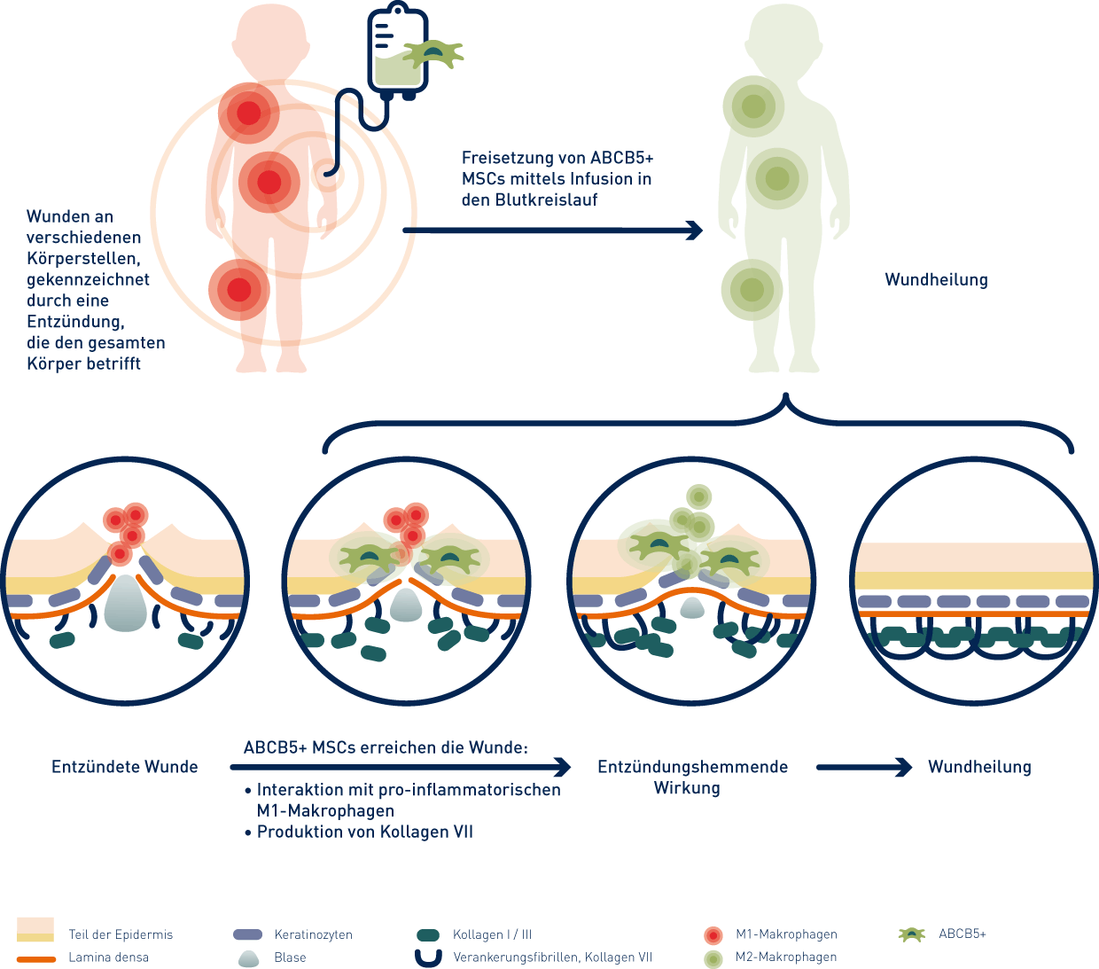 infografik-abcb5-skin-process-en